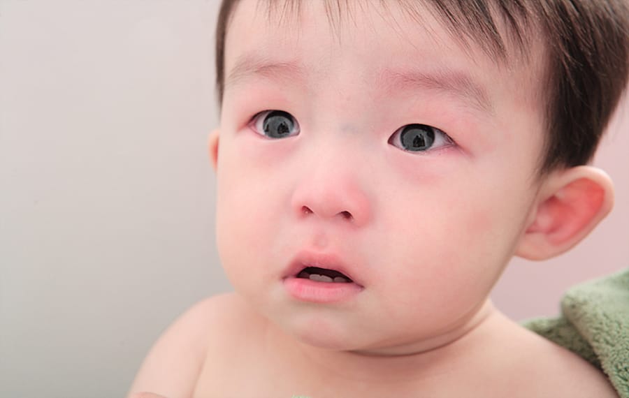 잠 못자는 아기 소아 야제증