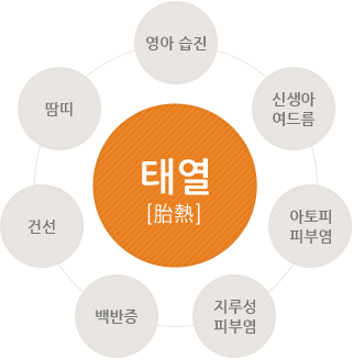 영아습진 신생아여드름 아초피피부염 지루성피부염 백반증 건선 땀띠 태열