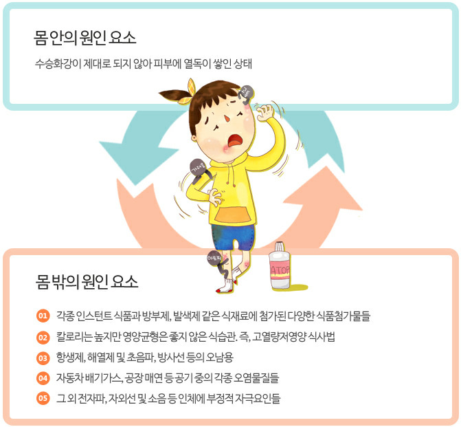 아토피 : 몸 안의 원인요소 / 몸 밖의 원인요소